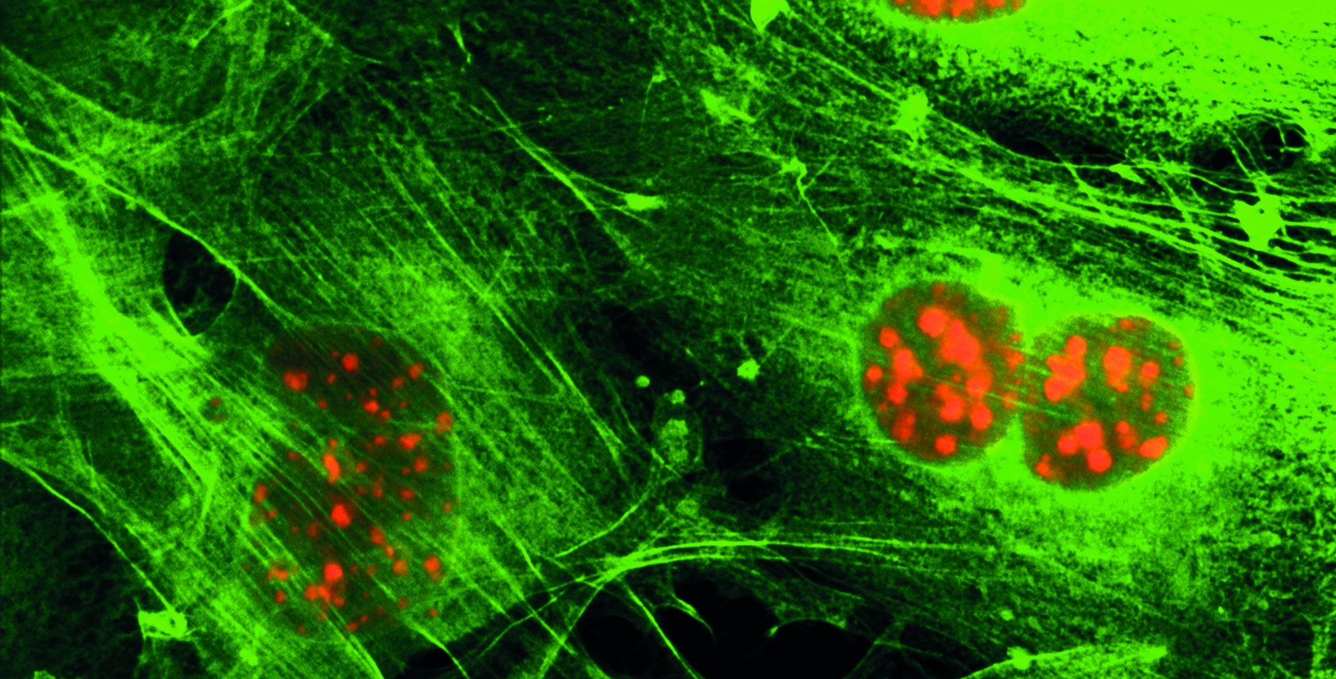 Abstract microscopic view of a virus